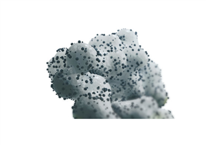 Kyphon VuE™ bone cement